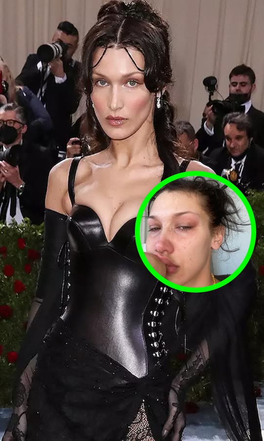 Bella Reveals She Blacked Out At Met Gala 💔😢
