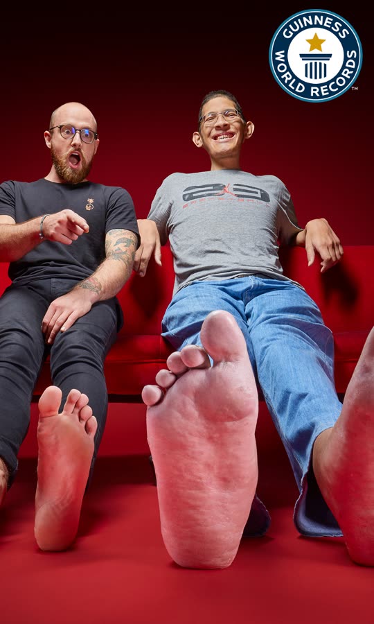 He Has The World's Largest Feet