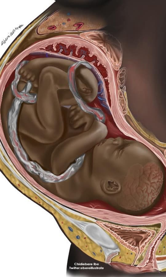 Cette illustration de fœtus noir n'est pas anodine